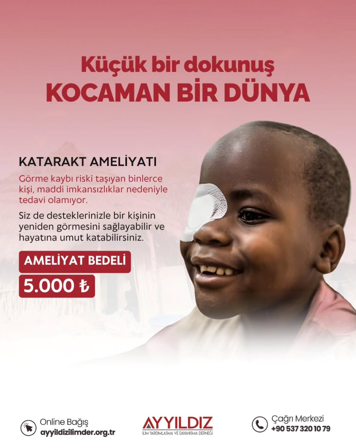 KATARAKT AMELİYATI