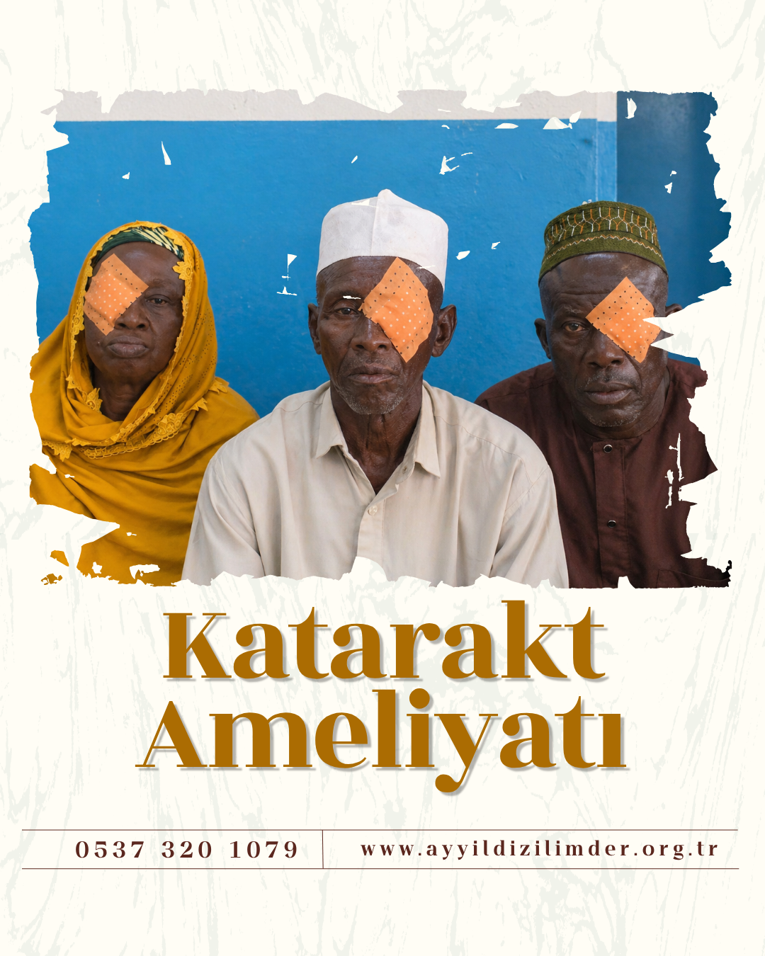 KATARAKT AMELİYATI